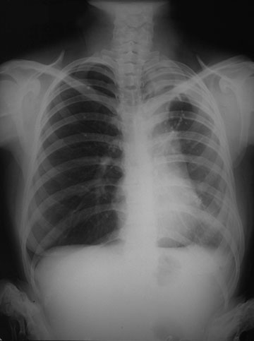 Pulmonary Physiology