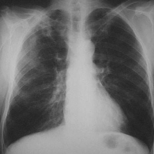 Pulmonary Radiologic Images