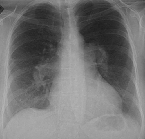 Pulmonary Radiologic Images