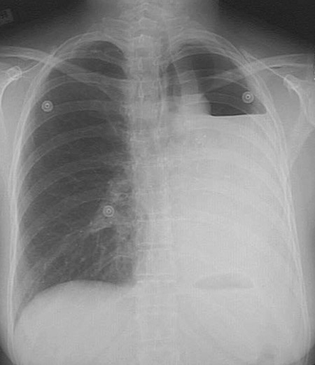 Pulmonary Radiologic Images