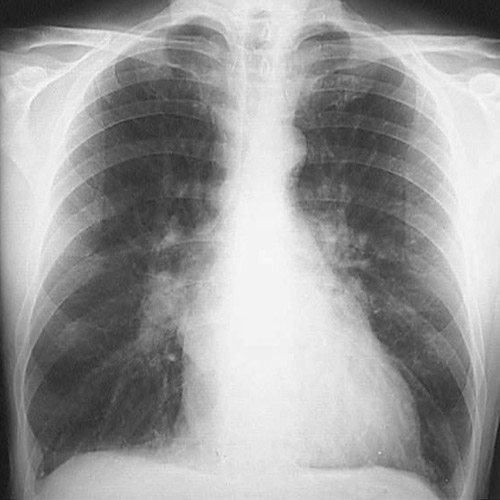 Pulmonary Radiologic Images