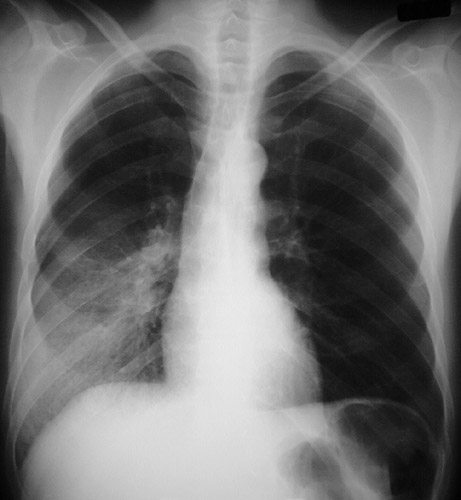 Pulmonary Radiologic Images