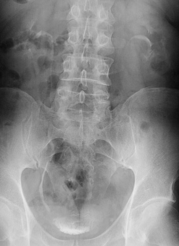 Genitourinary Tract Radiologic Images