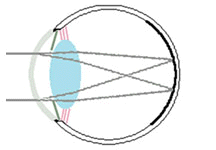 Ophthalmic Pathology