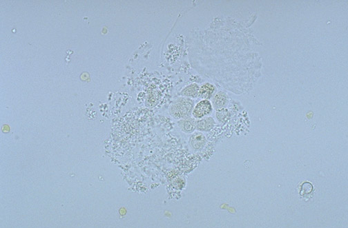 Urinalysis