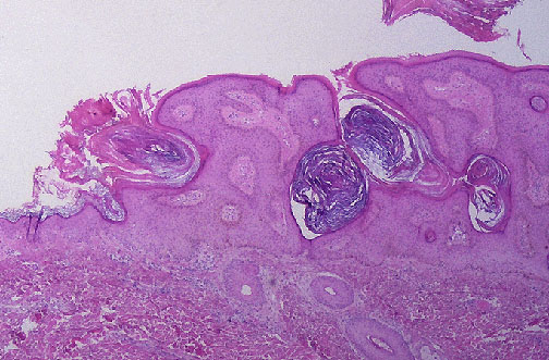 Dermatopathology