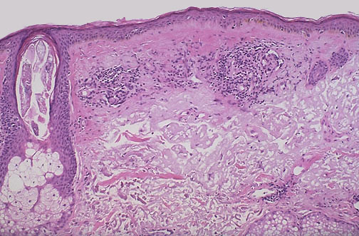 Dermatopathology