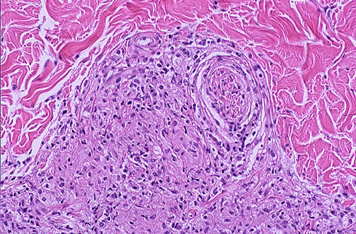 Dermatopathology