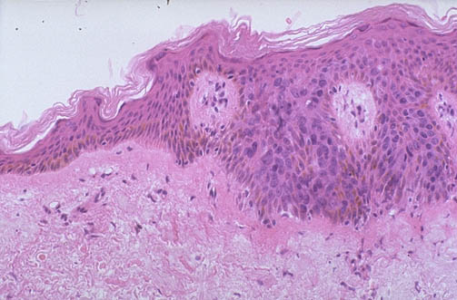 Histology Clinical Correlations