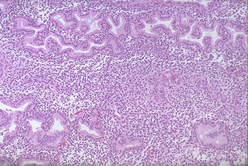 Pathology secretory endometrium Endometrium