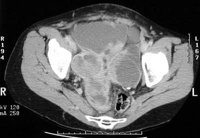 Genitourinary Tract Radiologic Images