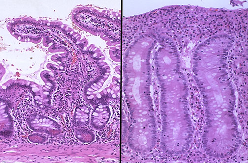 Gastrointestinal Physiology