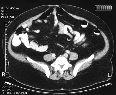 Gastrointestinal Radiologic Images