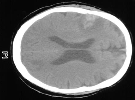 CNS Radiologic Images