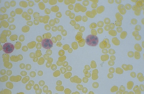 Hematopathology 8574