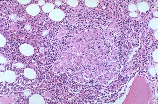 Hematopathology