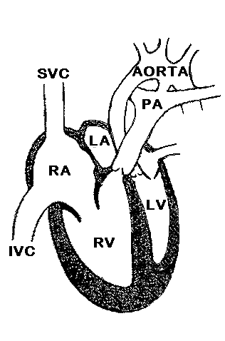 Cardiovascular Pathology