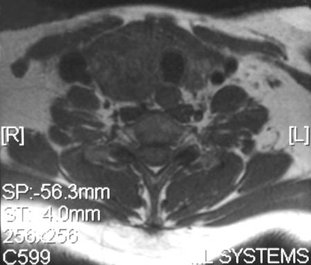 Head & Neck and Endocrine Radiologic Images