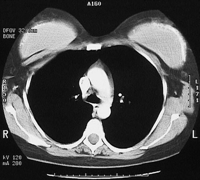 Radiologic Images