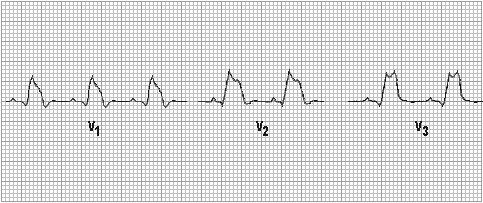 Cardiac Physiology