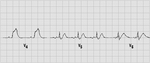 Cardiac Physiology